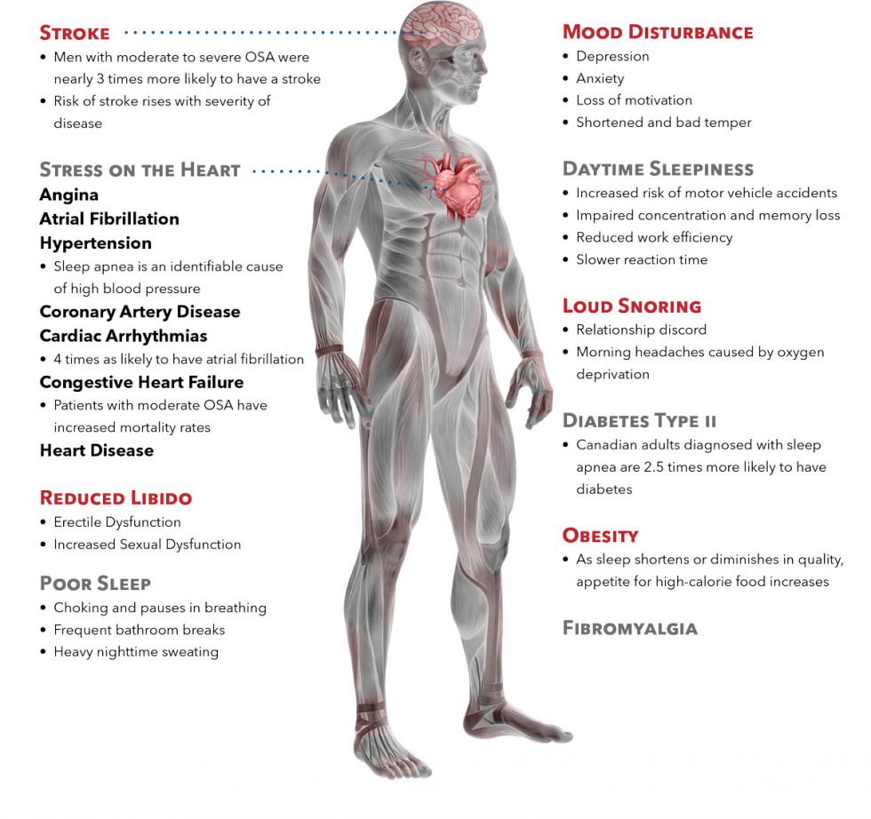 Home Sleep Apnea Testing - Sleep Medix - CPAP Clinic and Supplies